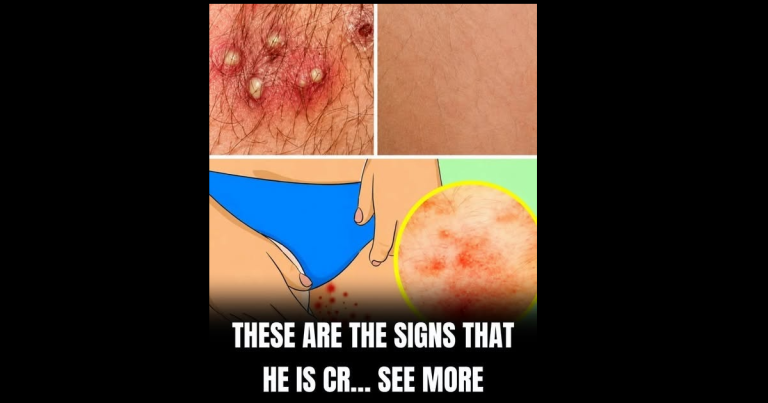 The Importance of Paying Attention to Skin Changes