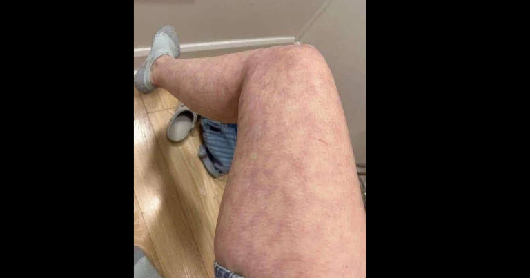 These are the consequences of sleeping with the… See more