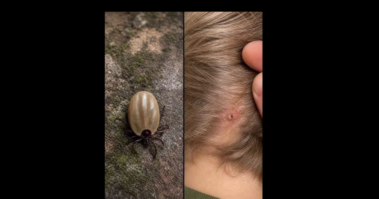 Does anyone know what type of insect this is? I just spotted it on my son’s head… Check the 1st comment 👇👇 ‍‌﻿​⠀͏
