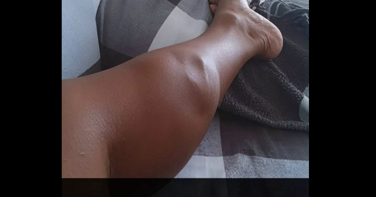 😨 If You Often Get Leg Cramps At Night, Your Body May Be Trying To Tell You Something 👇