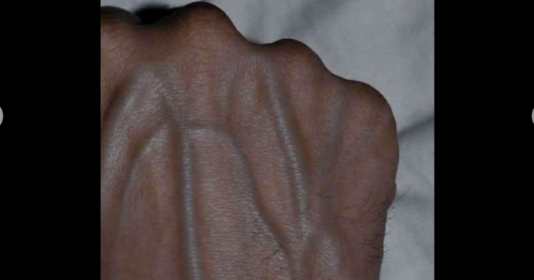 If you have visible veins, it means you are….