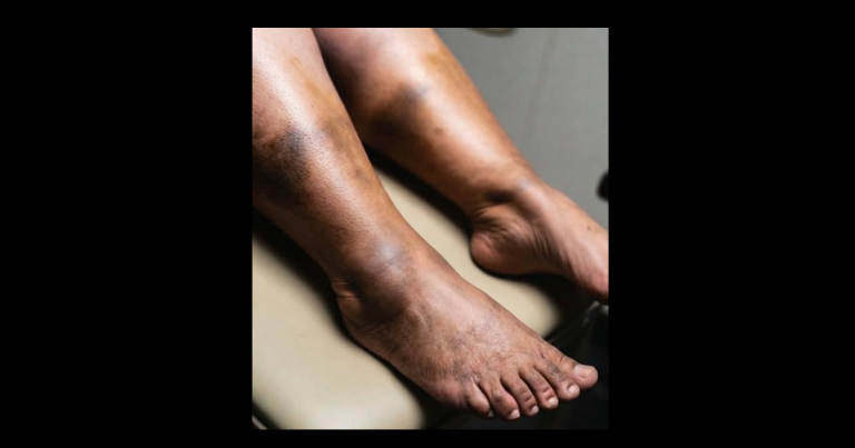 These are the consequences of sleeping with a… See more