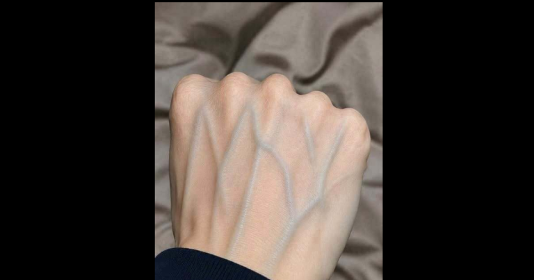 If you have visible veins, it means you are….