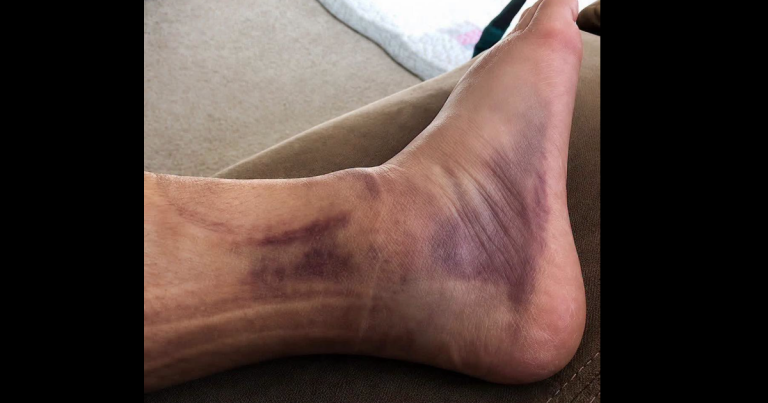 These are the consequences of wearing… See more